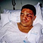 ten worst case of police brutality in history